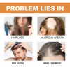 EELHOE Hair Enhancer Bottle Strengthens and repairs hair, prevents hair loss, strengthens hair roots, strengthens hair